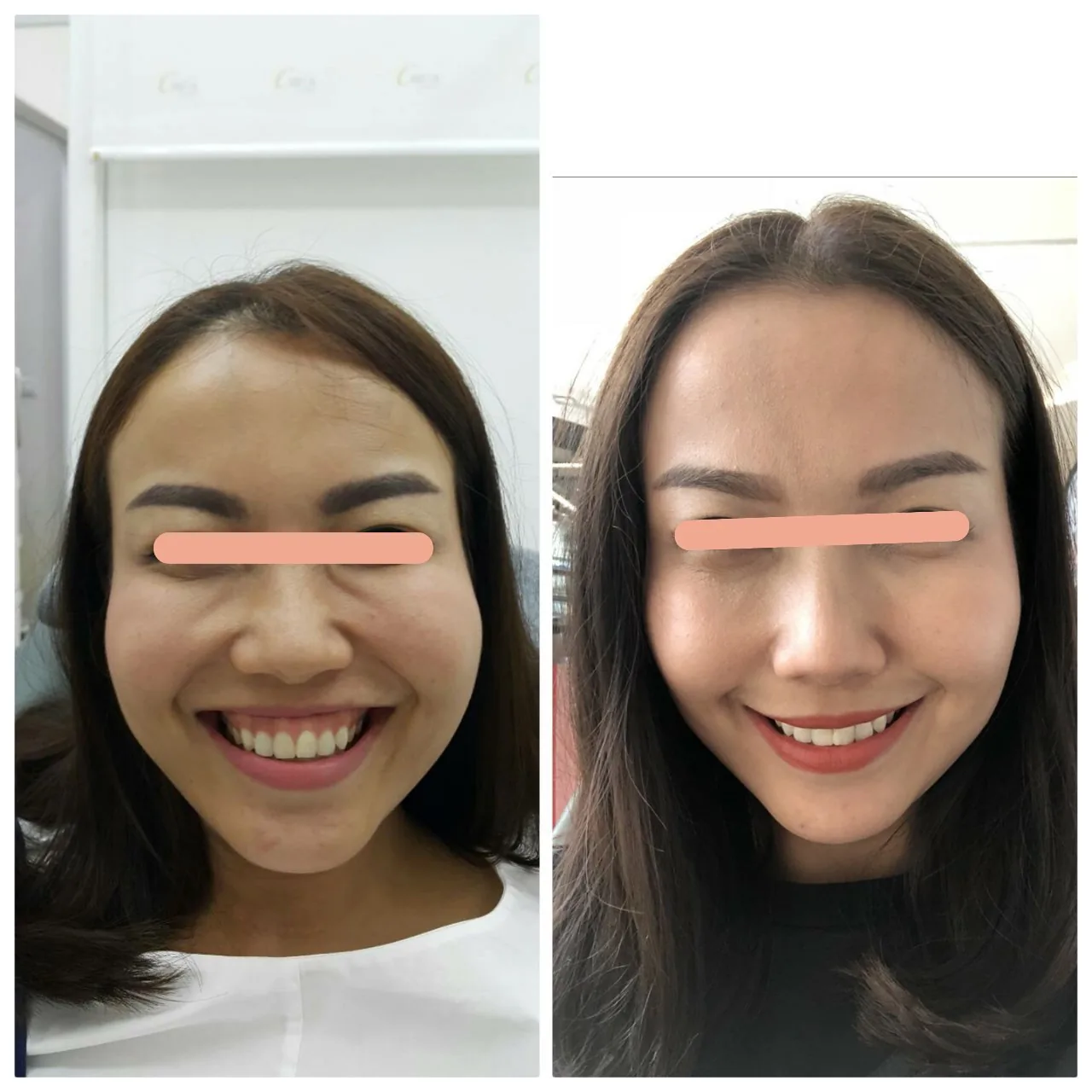 Mona Lisa Smile, Full Smile 1