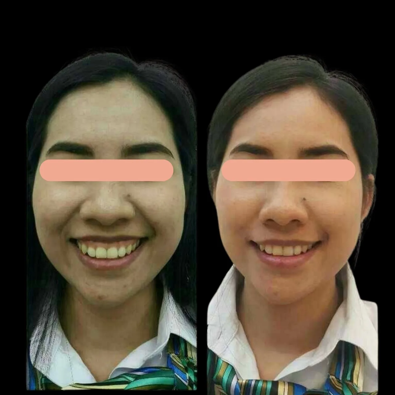 Mona Lisa Smile, Full Smile 8