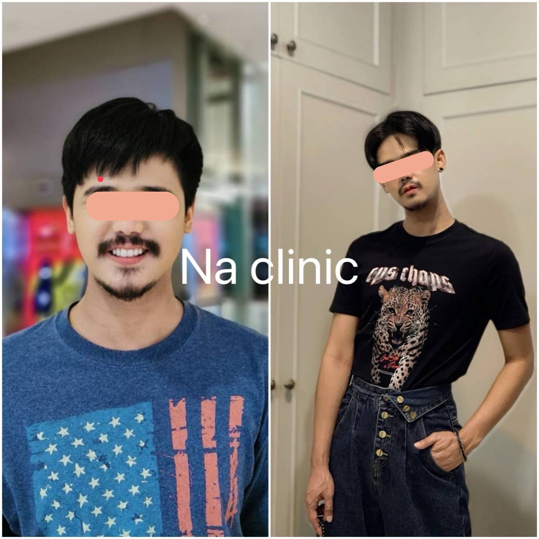 Body Composition Change 3