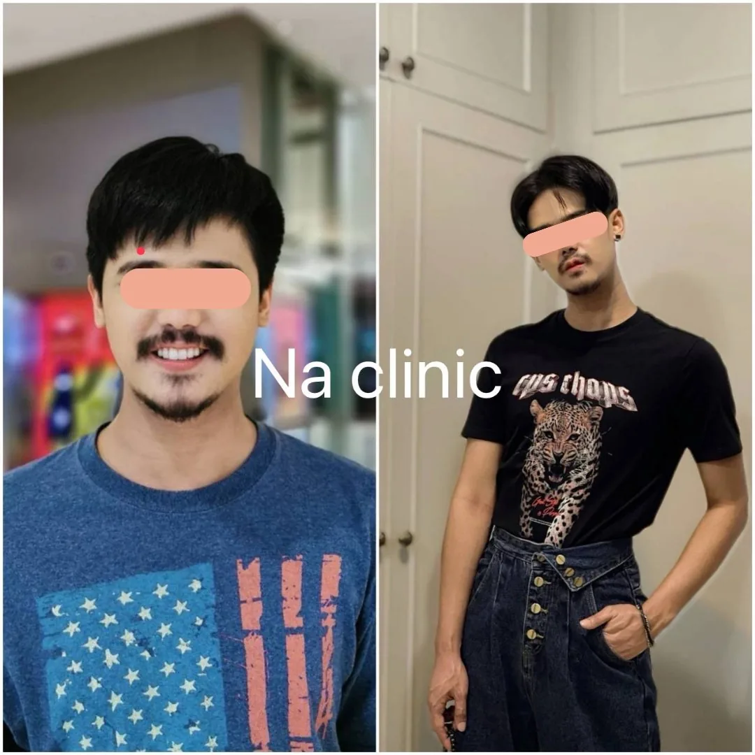 Body Composition Change 3