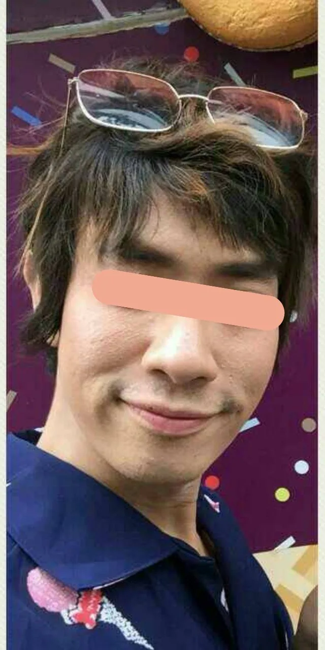 Nose Refinement Program before